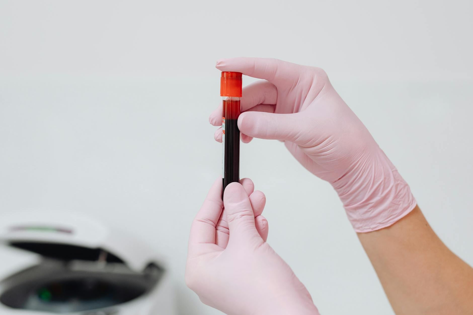 A gloved hand holding a labelled blood sample